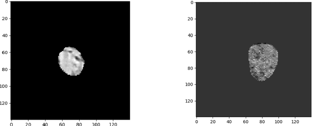 Figure 3 for CNN-based Survival Model for Pancreatic Ductal Adenocarcinoma in Medical Imaging