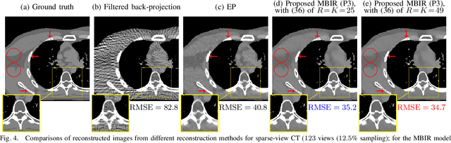 Figure 4 for Convolutional Analysis Operator Learning: Acceleration, Convergence, Application, and Neural Networks