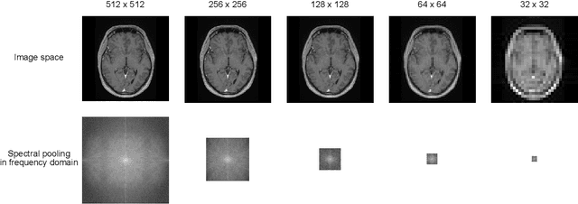 Figure 2 for k-strip: A novel segmentation algorithm in k-space for the application of skull stripping