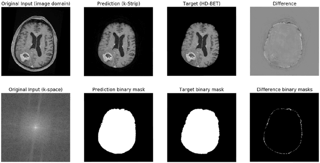 Figure 3 for k-strip: A novel segmentation algorithm in k-space for the application of skull stripping