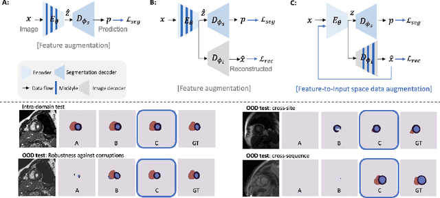 Figure 1 for MaxStyle: Adversarial Style Composition for Robust Medical Image Segmentation