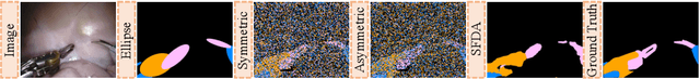 Figure 4 for Joint Class-Affinity Loss Correction for Robust Medical Image Segmentation with Noisy Labels