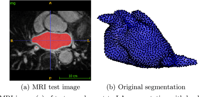 Figure 4 for Mixture Modeling of Global Shape Priors and Autoencoding Local Intensity Priors for Left Atrium Segmentation