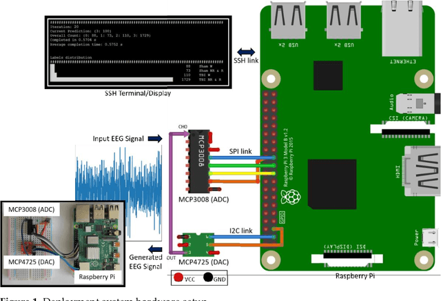 Figure 1 for A Raspberry Pi based Traumatic Brain Injury Detection System for Single-Channel Electroencephalogram