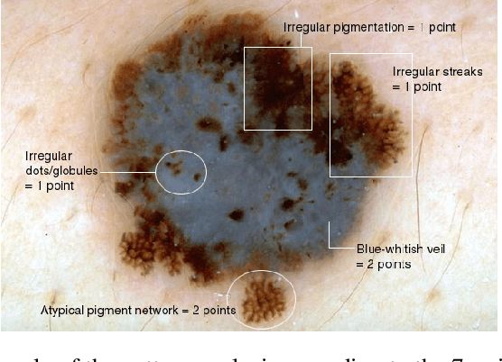 Figure 3 for Recent advances in deep learning applied to skin cancer detection