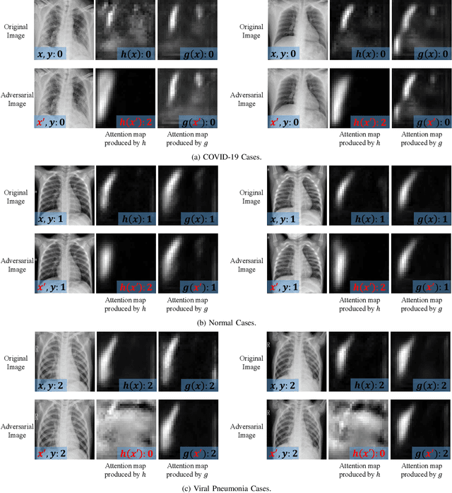 Figure 3 for MedRDF: A Robust and Retrain-Less Diagnostic Framework for Medical Pretrained Models Against Adversarial Attack