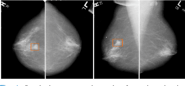 Figure 1 for Multi-task fusion for improving mammography screening data classification