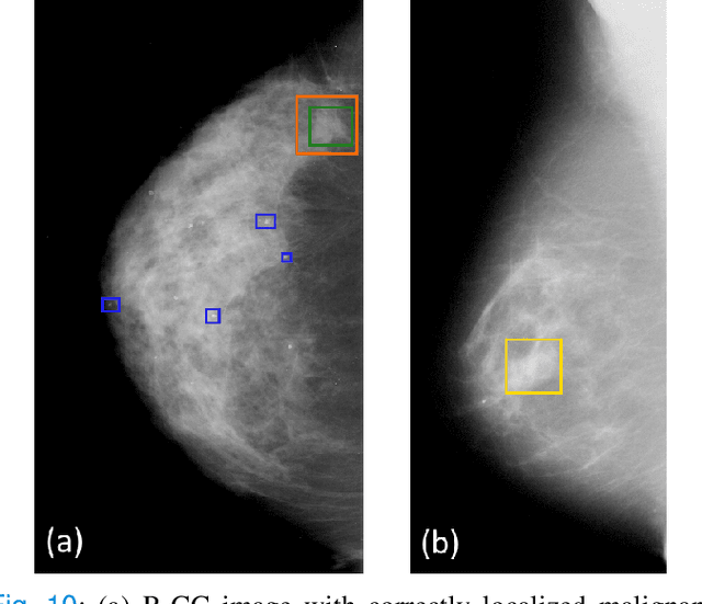 Figure 2 for Multi-task fusion for improving mammography screening data classification
