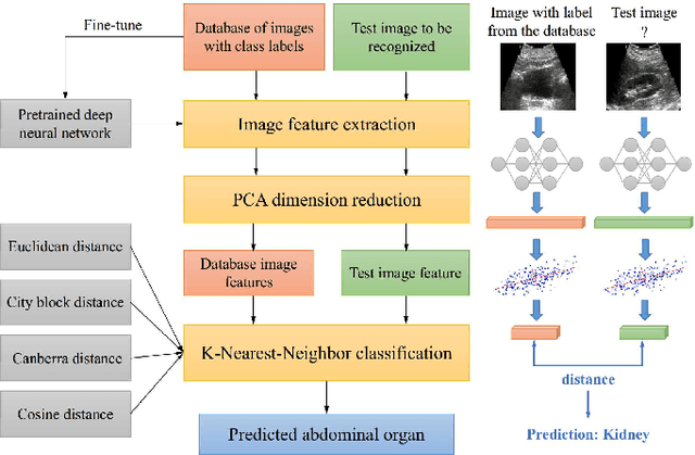 Figure 1 for Automatic Recognition of Abdominal Organs in Ultrasound Images based on Deep Neural Networks and K-Nearest-Neighbor Classification