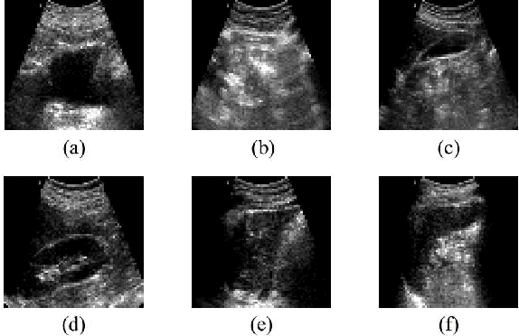 Figure 2 for Automatic Recognition of Abdominal Organs in Ultrasound Images based on Deep Neural Networks and K-Nearest-Neighbor Classification