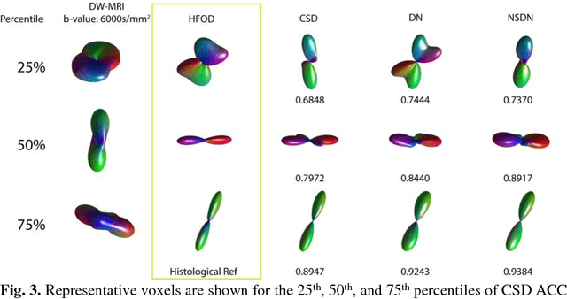 Figure 3 for Inter-Scanner Harmonization of High Angular Resolution DW-MRI using Null Space Deep Learning