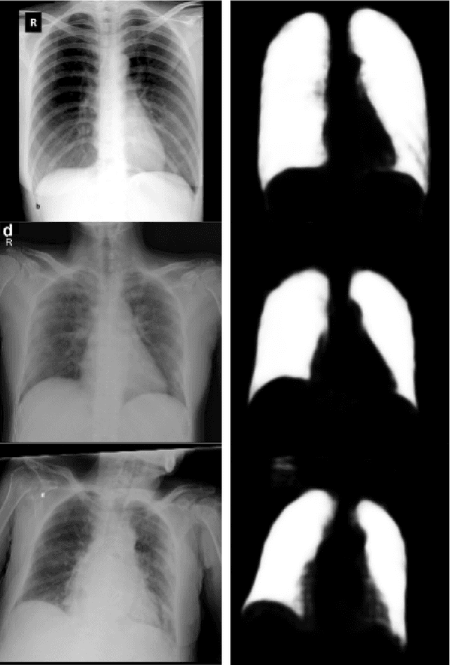 Figure 1 for COVID-19 detection using chest X-rays: is lung segmentation important for generalization?