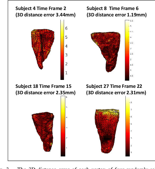 Figure 3 for Instantiation-Net: 3D Mesh Reconstruction from Single 2D Image for Right Ventricle