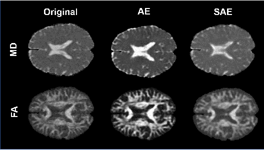 Figure 2 for Patch vs. Global Image-Based Unsupervised Anomaly Detection in MR Brain Scans of Early Parkinsonian Patients