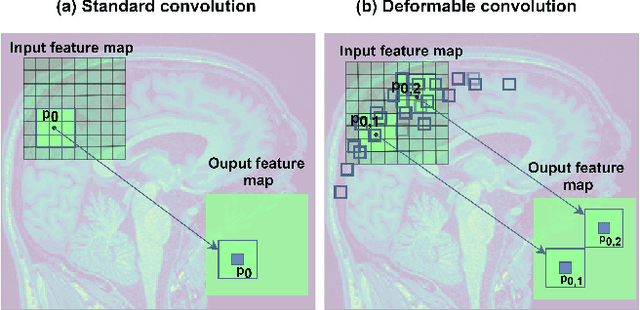 Figure 3 for 3D Deformable Convolutions for MRI classification