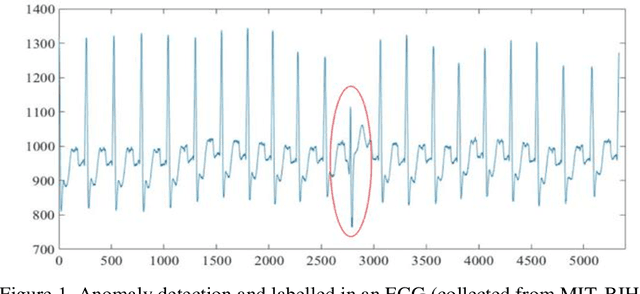 Figure 1 for A Modified Dynamic Time Warping  Approach and Innovative Average Non-Self Match Distance  Method for Anomaly Detection in ECG Recordings