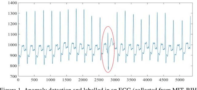 Figure 1 for A Modified Dynamic Time Warping (MDTW) Approach and Innovative Average Non-Self Match Distance (ANSD) Method for Anomaly Detection in ECG Recordings