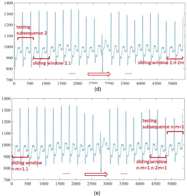 Figure 3 for A Modified Dynamic Time Warping  Approach and Innovative Average Non-Self Match Distance  Method for Anomaly Detection in ECG Recordings