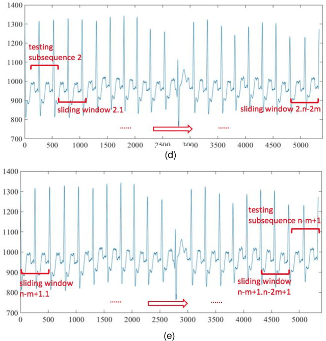 Figure 3 for A Modified Dynamic Time Warping (MDTW) Approach and Innovative Average Non-Self Match Distance (ANSD) Method for Anomaly Detection in ECG Recordings