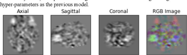 Figure 4 for Deep Labeling of fMRI Brain Networks Using Cloud Based Processing