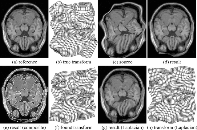 Figure 1 for Adaptive Regularization of Ill-Posed Problems: Application to Non-rigid Image Registration