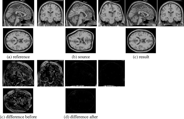 Figure 2 for Adaptive Regularization of Ill-Posed Problems: Application to Non-rigid Image Registration