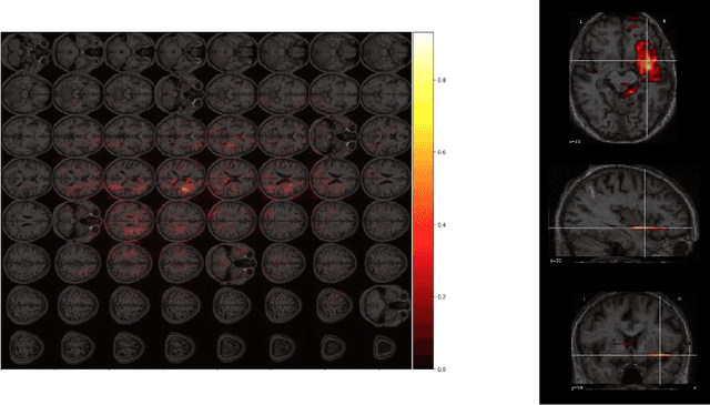 Figure 3 for Predicting Language Recovery after Stroke with Convolutional Networks on Stitched MRI