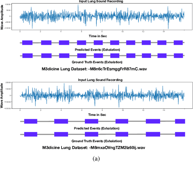 Figure 4 for Robust and Interpretable Temporal Convolution Network for Event Detection in Lung Sound Recordings