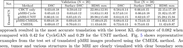 Figure 4 for Deep cross-modality (MR-CT) educed distillation learning for cone beam CT lung tumor segmentation