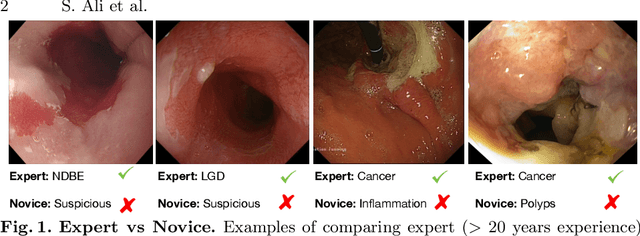 Figure 1 for Additive Angular Margin for Few Shot Learning to Classify Clinical Endoscopy Images