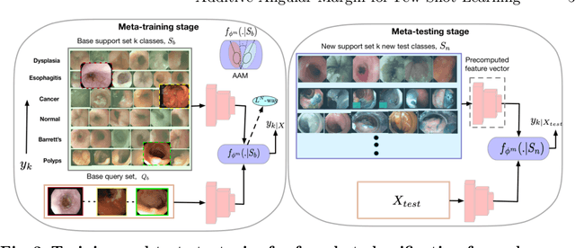 Figure 4 for Additive Angular Margin for Few Shot Learning to Classify Clinical Endoscopy Images