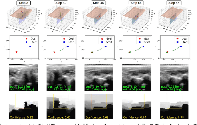 Figure 3 for Image-Guided Navigation of a Robotic Ultrasound Probe for Autonomous Spinal Sonography Using a Shadow-aware Dual-Agent Framework