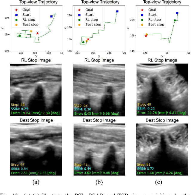 Figure 4 for Image-Guided Navigation of a Robotic Ultrasound Probe for Autonomous Spinal Sonography Using a Shadow-aware Dual-Agent Framework