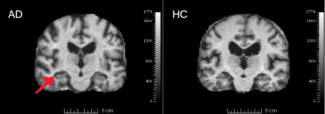Figure 2 for Modeling Information Flow Through Deep Neural Networks