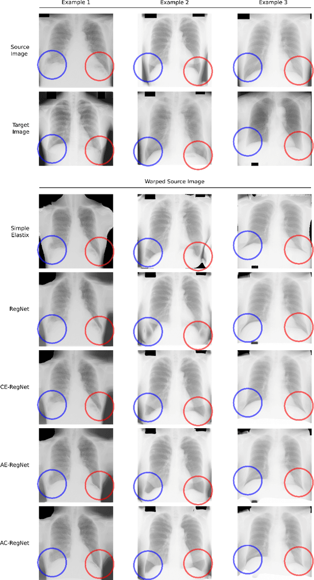 Figure 4 for Learning Deformable Registration of Medical Images with Anatomical Constraints