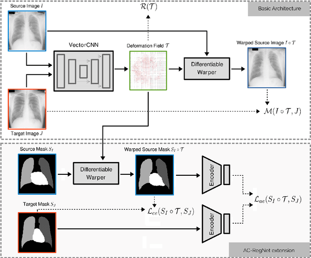 Figure 1 for Learning Deformable Registration of Medical Images with Anatomical Constraints