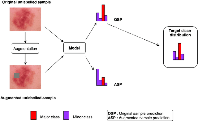 Figure 2 for Semi-supervised learning for medical image classification using imbalanced training data
