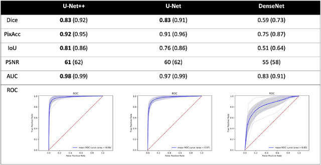 Figure 2 for Segmentation of kidney stones in endoscopic video feeds