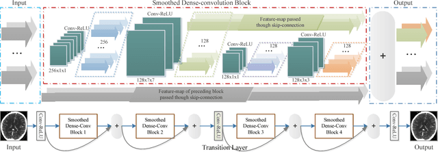 Figure 1 for SDCNet: Smoothed Dense-Convolution Network for Restoring Low-Dose Cerebral CT Perfusion