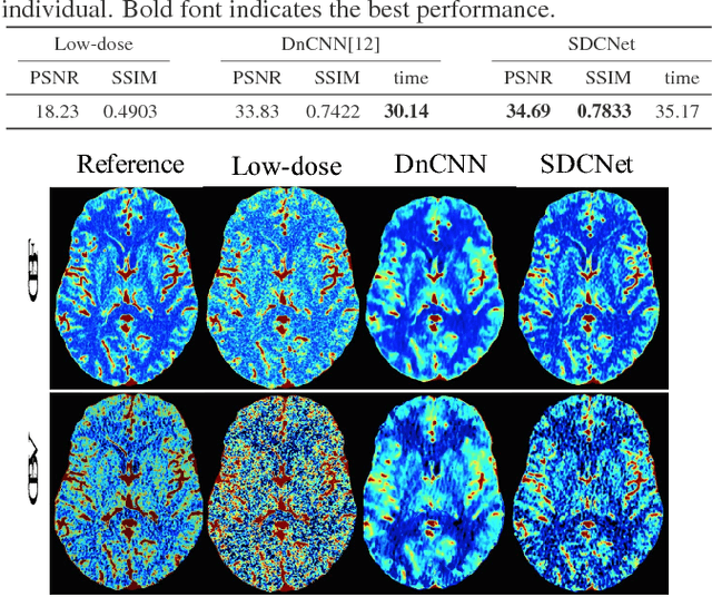 Figure 2 for SDCNet: Smoothed Dense-Convolution Network for Restoring Low-Dose Cerebral CT Perfusion