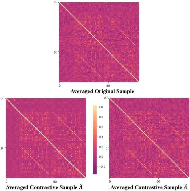 Figure 2 for Contrastive Brain Network Learning via Hierarchical Signed Graph Pooling Model