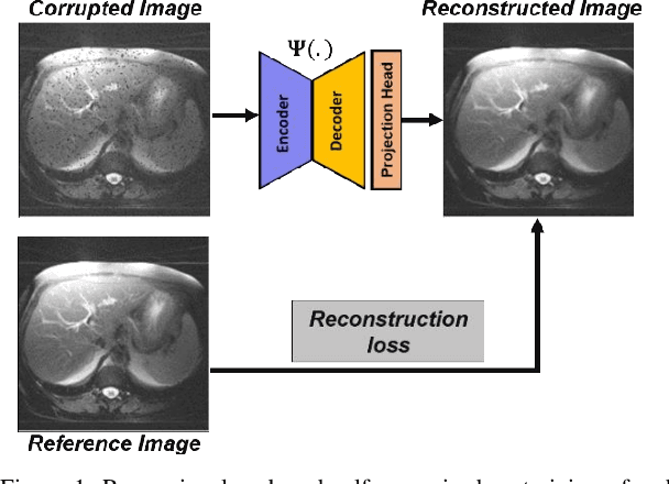 Figure 1 for Learning to segment with limited annotations: Self-supervised pretraining with regression and contrastive loss in MRI