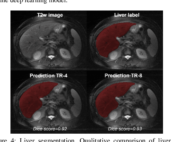 Figure 4 for Learning to segment with limited annotations: Self-supervised pretraining with regression and contrastive loss in MRI