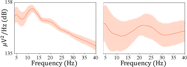 Figure 1 for Multi-Scale Neural network for EEG Representation Learning in BCI