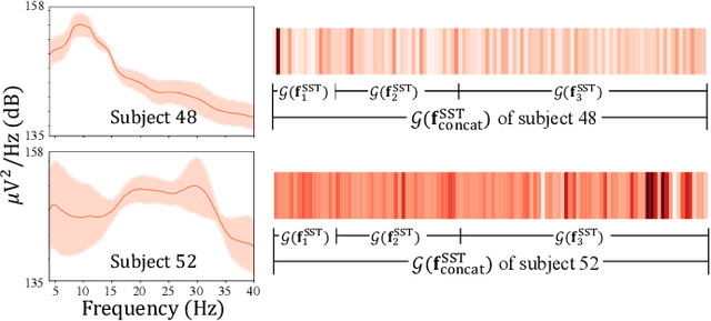 Figure 3 for Multi-Scale Neural network for EEG Representation Learning in BCI