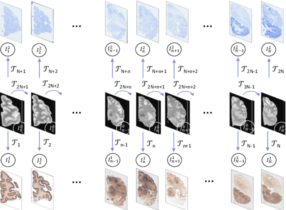 Figure 1 for Robust joint registration of multiple stains and MRI for multimodal 3D histology reconstruction: Application to the Allen human brain atlas