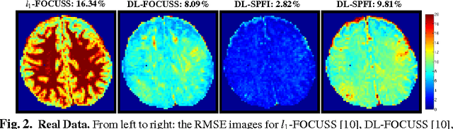 Figure 2 for Regularized Spherical Polar Fourier Diffusion MRI with Optimal Dictionary Learning