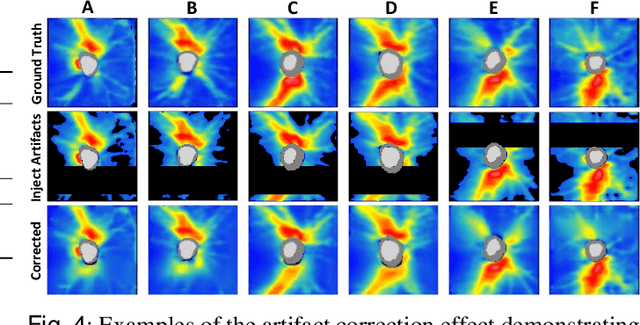 Figure 4 for Artifact-Tolerant Clustering-Guided Contrastive Embedding Learning for Ophthalmic Images