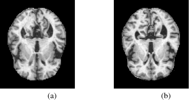 Figure 1 for Towards Alzheimer's Disease Classification through Transfer Learning