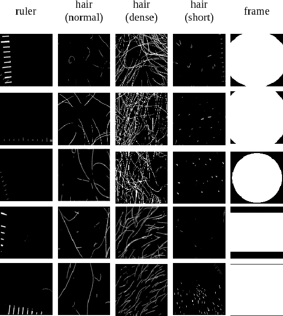 Figure 4 for The biasing effect of GAN-based augmentation methods on skin lesion images